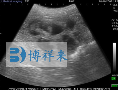 牛怀孕28天影像图