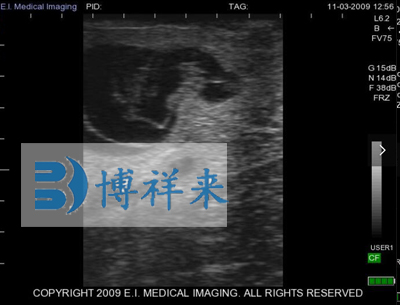 牛双胞胎影像图