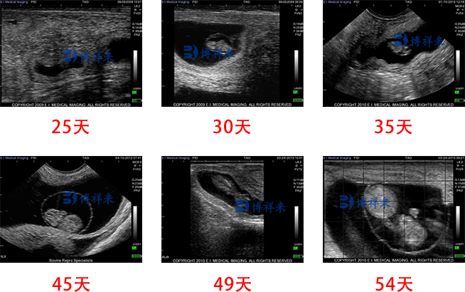 牛用B超胎龄检测超声图像
