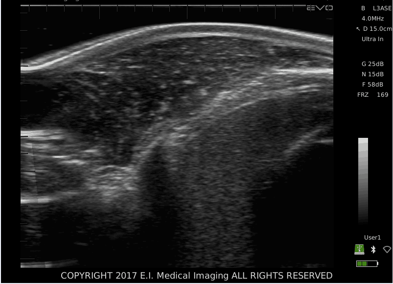 牛眼肌面积超声图像