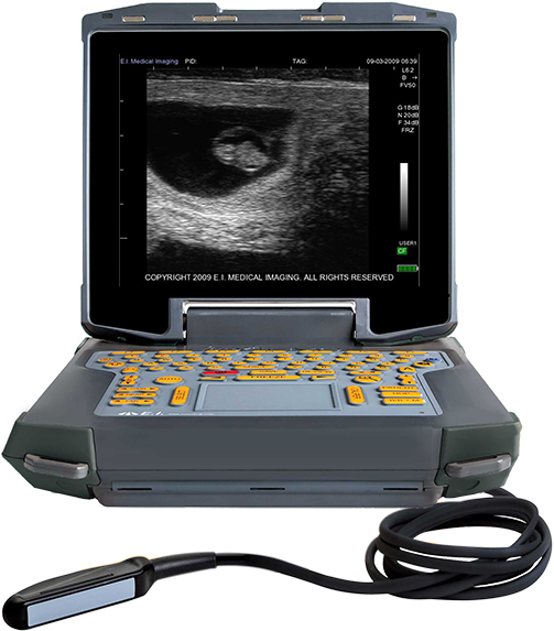 高清牛用B超测孕仪