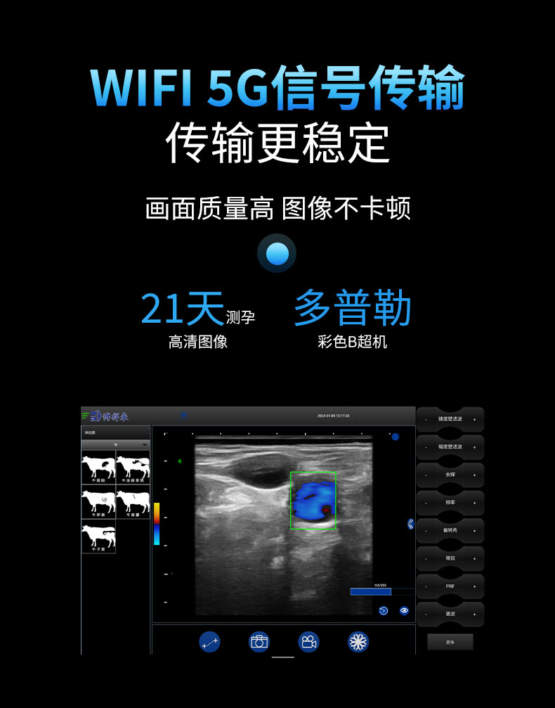 多普勒无线B超机