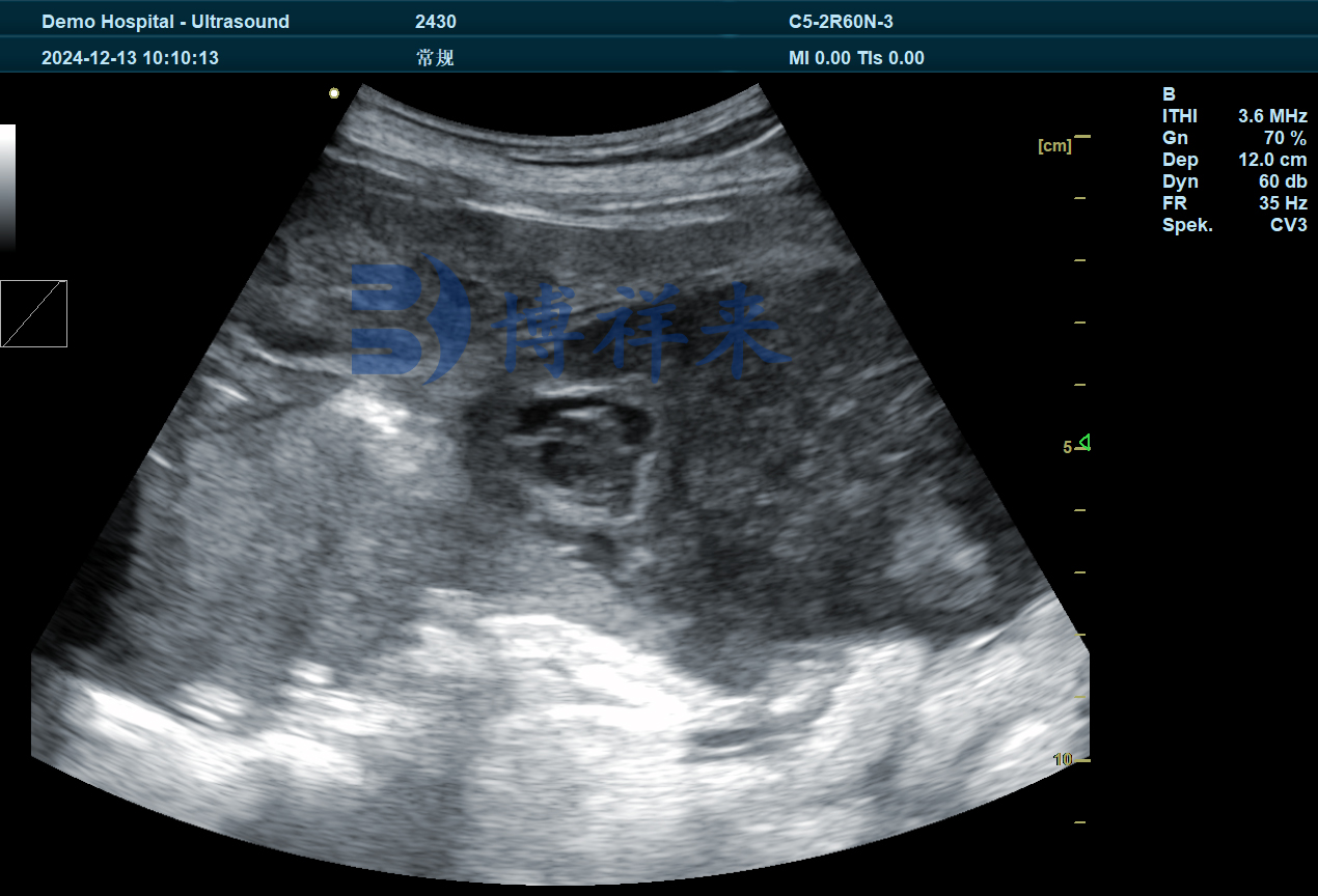 猪卵巢上的卵泡超声图