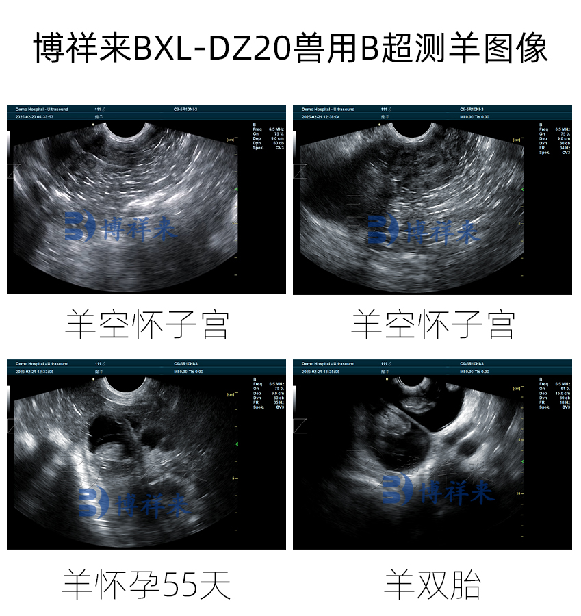 羊怀孕各天数超声图像